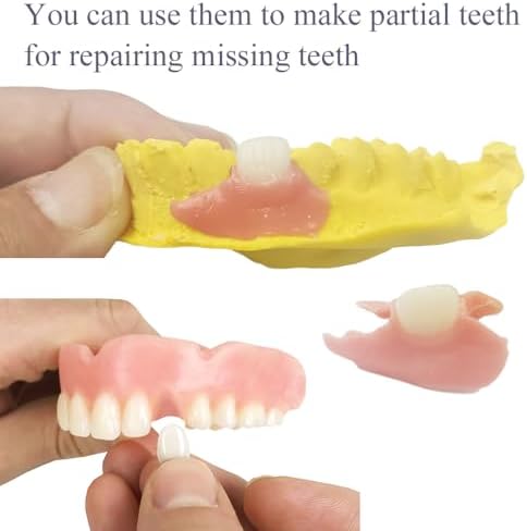 Missing Teeth Repair Kit -DIY Denture Parts at home Denture Material kit - Image 3