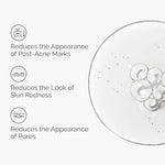Lightweight aloe vera gel for scars and spot scar removal cream alternative