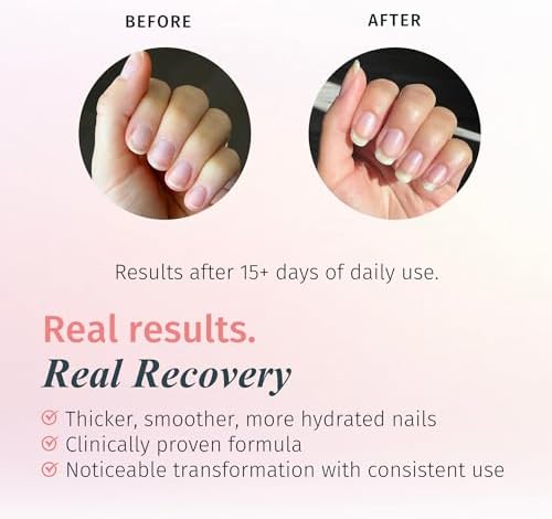 Nail strengthening polish featuring keratin and calcium for reinforcing thin nails