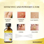 Bee venom boosted formula for plantar wart and corn removal