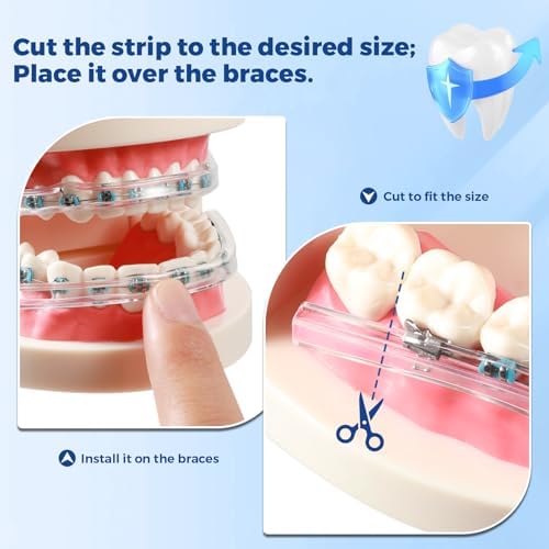 Transparent silicone C shape brace shield strip being measured for trimming