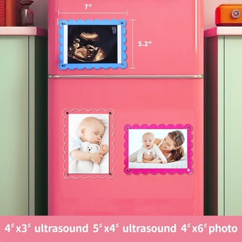Mlatnod clear pregnancy announcement frame with decorative scalloped edges showcasing double sided view.