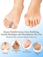 PGRODE gel toe spacers applied to feet demonstrating proper alignment between the big toe and second toe.