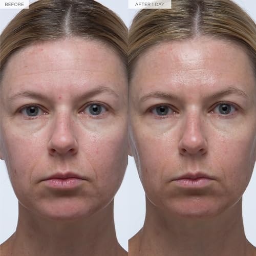 Korean inspired vegan face serum with vitamin B5 ingredients