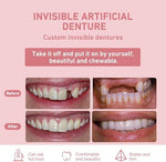 Side profile of flexible partial denture appliance
