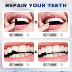 User applying moldable tooth repair material at home