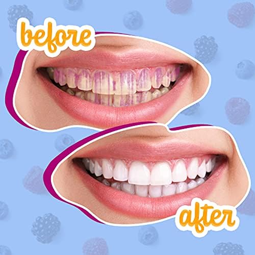 Family oral care routine using Lingito plaque disclosing tablets