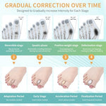Pitoyteck Bunion Corrector showing the dual loop design secured on human toes for alignment.