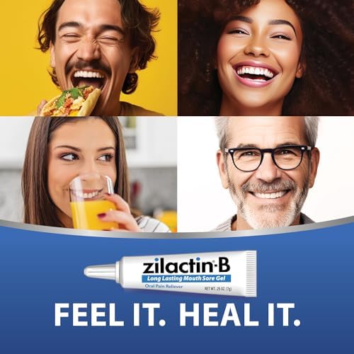 Applying a thin coat of Zilactin-B fast acting canker sore gel with a cotton swab.
