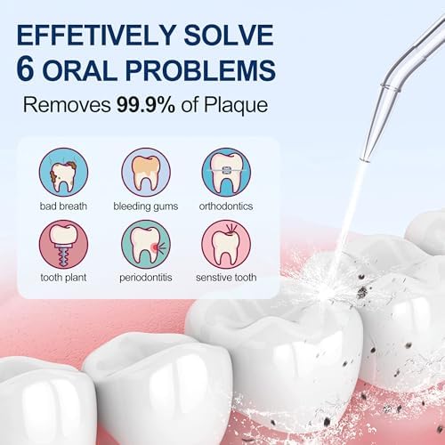 Six different replacement jet tips included with the Mocel water teeth cleaner.