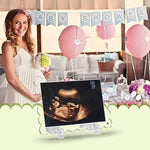 Close up view of the strong embedded magnets on the corners of the Mlatnod sonography photo frame.