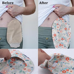 Side view of the ostomy bag cover demonstrating its stretchy and flexible fit.