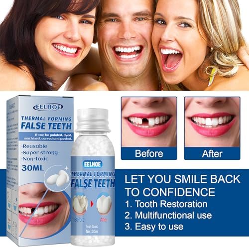 Demonstration of temporary tooth gap filling