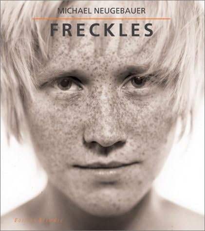 Freckles - Image 1