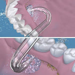 Close up of the specialized curved nozzle tip designed for cleaning fixed bridges