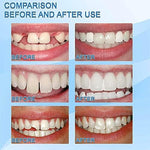 Customized fake tooth match using coffee tinting for natural appearance.