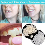 Close up of moldable thermal beads for dental repair