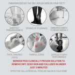 Close up of double sided stainless steel foot file for dead skin removal