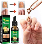Turmeric infused nail oil providing assistance with strengthening thin and weak nails