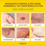 SupreH Salicylic Acid and Bee Venom liquid solution for plantar wart removal.