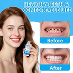 XLMCWT temporary tooth replacement kit contents and beads