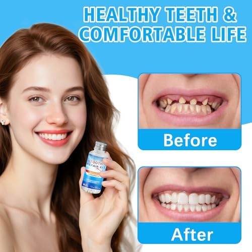 XLMCWT temporary tooth replacement kit contents and beads