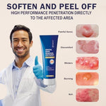 Imported MEOLY skin treatment ointment for genital and plantar warts.