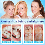 Zinc oxide eugenol cement kit packaging for temporary tooth repair