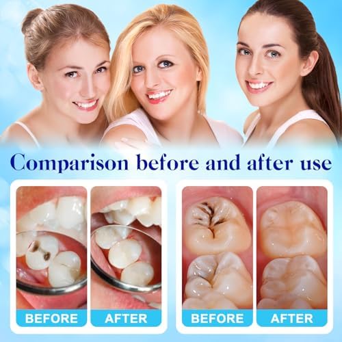 Zinc oxide eugenol cement kit packaging for temporary tooth repair