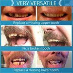 Close up of artificial teeth rows in multiple shades for missing tooth fix.