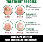 IMOLL professional nail care products works to provide assistance with long nails
