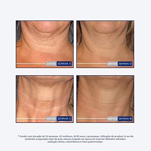 NeoStrata Skin Active Triple Firming Neck Cream, 2.8 oz - Image 7
