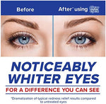 Three pack of Clear Eyes Maximum Redness Relief for eye irritation