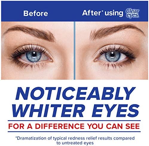 Three pack of Clear Eyes Maximum Redness Relief for eye irritation