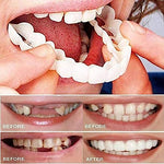 Moldable fake teeth repair kit contents
