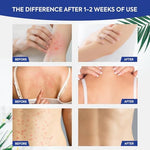 Charmpoo white cream texture for itchy skin relief in groin area