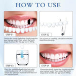 Steps for using temporary tooth repair kit with hot water