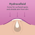 Hypoallergenic drug free acne pimple patches for oily skin care management application details.