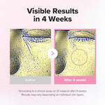 Korean skincare solution for large pores by Beauty of Joseon showing clear dropper