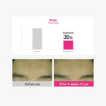 Rovectin Cica Care Blemish Clearing Cream skincare routine flat lay