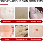 QQE liquid treatment for plantar and flat warts showing clear liquid consistency.