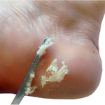AKOAK foot care tool stainless steel finish
