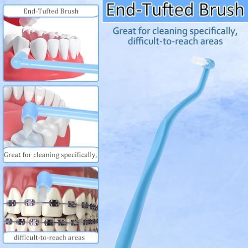 Detailed view of the soft nylon bristles designed for cleaning braces and dental implants.