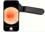 USB-C charging port and battery indicator lights on dermatoscope handle