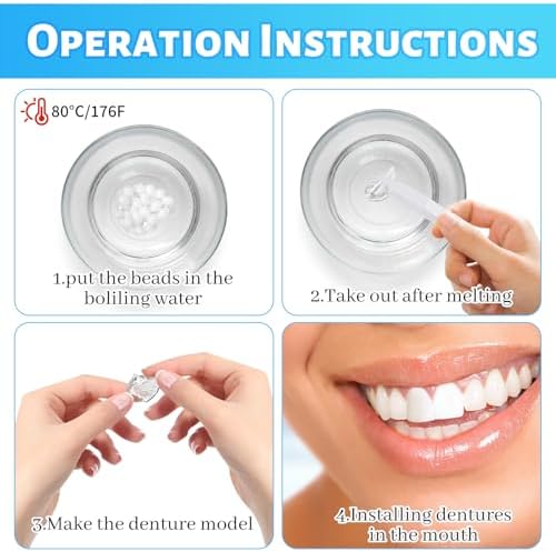 Translucent softened polymer material from the tooth repair kit ready for DIY custom shaping.