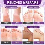 Before and after visualization of smooth heels after using the XIWEIOO callus remover system.
