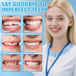 Close up of XLMCWT thermoplastic dental beads for DIY repair