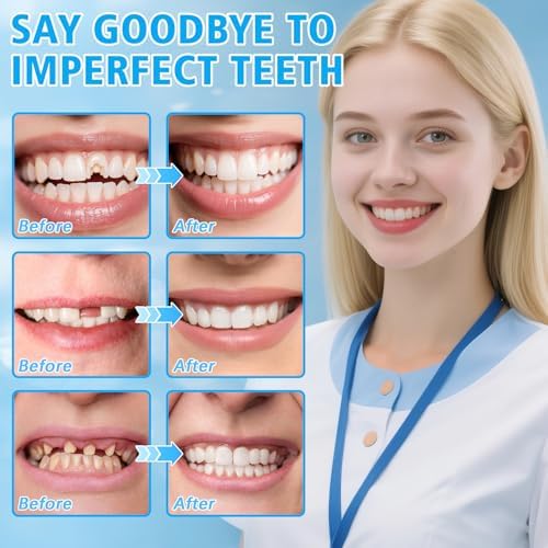 Close up of XLMCWT thermoplastic dental beads for DIY repair