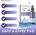 Close up of the spray nozzle on Brangato eyelid cleanser for blepharitis treatment.