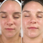 Intraceuticals Rejuvenate Daily Serum pump applicator and dropper design